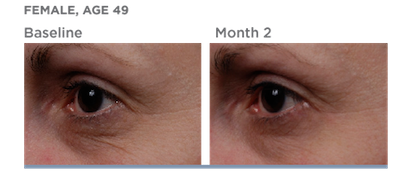 tns skinmedica serum after before essential